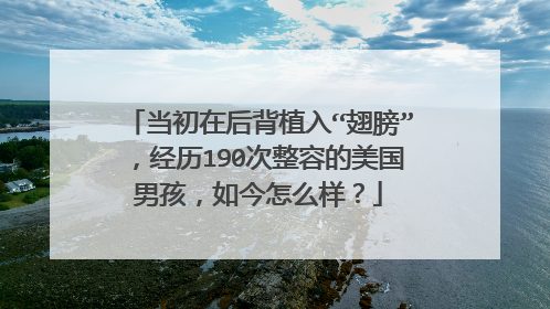 当初在后背植入“翅膀”,经历190次整容的美国男孩,如今怎么样?