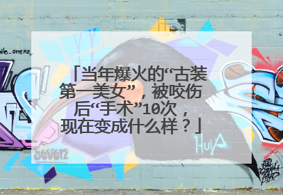 当年爆火的“古装第一美女”，被咬伤后“手术”10次，现在变成什么样？