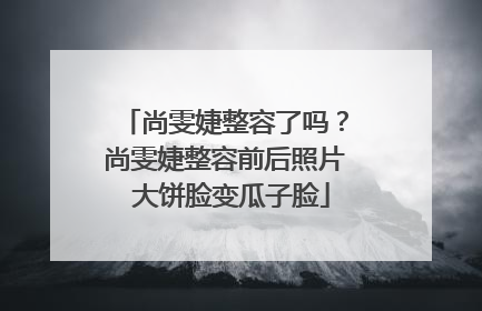 尚雯婕整容了吗?尚雯婕整容前后照片 大饼脸变瓜子脸