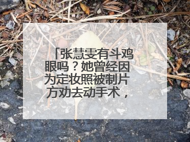 张慧雯有斗鸡眼吗？她曾经因为定妆照被制片方劝去动手术，这是真的吗？