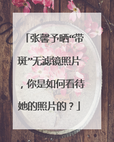 张馨予晒“带斑”无滤镜照片，你是如何看待她的照片的？