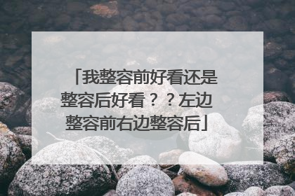 我整容前好看还是整容后好看？？左边整容前右边整容后
