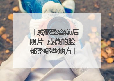 戚薇整容前后照片 戚薇的脸都整哪些地方