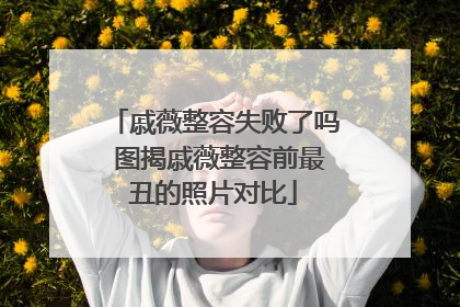 戚薇整容失败了吗 图揭戚薇整容前最丑的照片对比