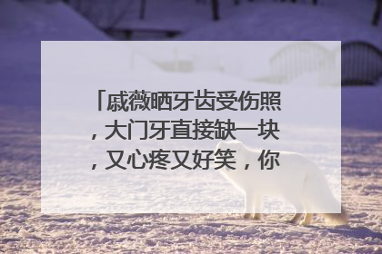 戚薇晒牙齿受伤照,大门牙直接缺一块,又心疼又好笑,你喜欢她吗?