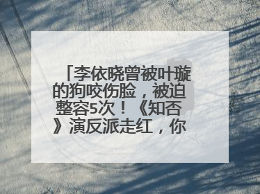 李依晓曾被叶璇的狗咬伤脸，被迫整容5次！《知否》演反派走红，你怎么看？