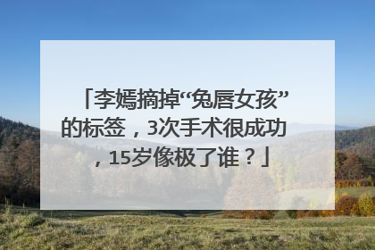 李嫣摘掉“兔唇女孩”的标签,3次手术很成功,15岁像极了谁?