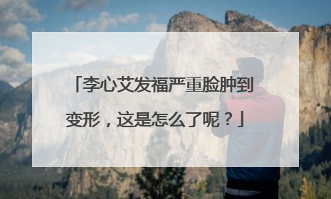 李心艾发福严重脸肿到变形,这是怎么了呢?