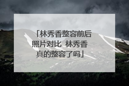 林秀香整容前后照片对比 林秀香真的整容了吗