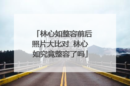 林心如整容前后照片大比对 林心如究竟整容了吗