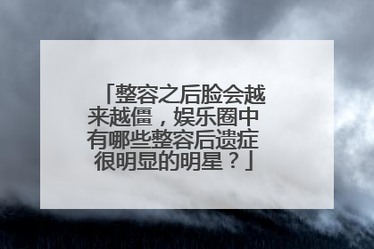 整容之后脸会越来越僵，娱乐圈中有哪些整容后遗症很明显的明星？