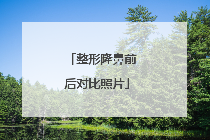 整形隆鼻前后对比照片