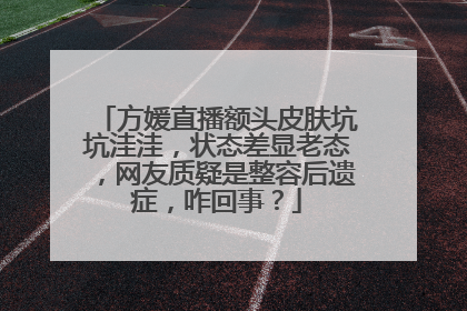 方媛直播额头皮肤坑坑洼洼,状态差显老态,网友质疑是整容后遗症,咋回事?