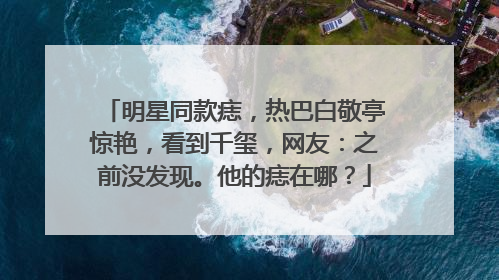 明星同款痣，热巴白敬亭惊艳，看到千玺，网友：之前没发现。他的痣在哪？