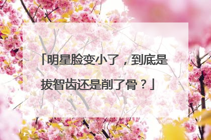 明星脸变小了,到底是拔智齿还是削了骨?