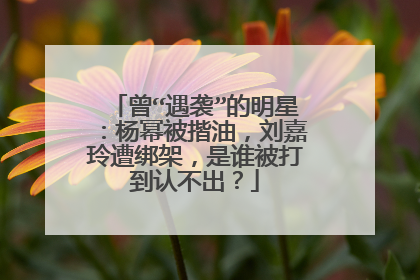 曾“遇袭”的明星：杨幂被揩油，刘嘉玲遭绑架，是谁被打到认不出？