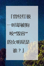 曾经红极一时却被狗咬“毁容”的女明星是谁?