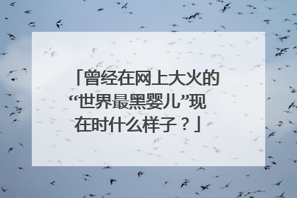 曾经在网上大火的“世界最黑婴儿”现在时什么样子？