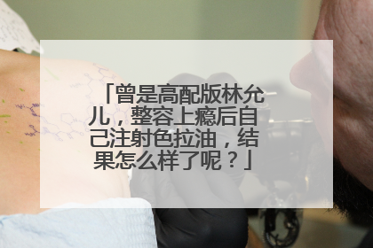 曾是高配版林允儿,整容上瘾后自己注射色拉油,结果怎么样了呢?