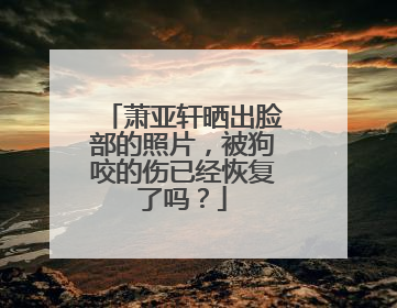 萧亚轩晒出脸部的照片,被狗咬的伤已经恢复了吗?