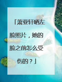 萧亚轩晒左脸照片,她的脸之前怎么受伤的?