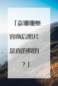 袁珊珊整容前后照片是真的假的?