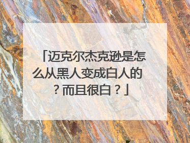 迈克尔杰克逊是怎么从黑人变成白人的?而且很白?