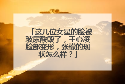 这几位女星的脸被玻尿酸毁了,王心凌脸部变形,张檬的现状怎么样?