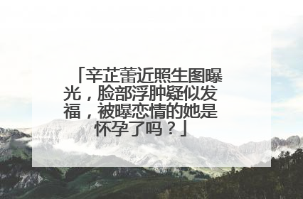 辛芷蕾近照生图曝光,脸部浮肿疑似发福,被曝恋情的她是怀孕了吗?