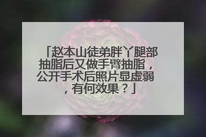 赵本山徒弟胖丫腿部抽脂后又做手臂抽脂，公开手术后照片显虚弱，有何效果？
