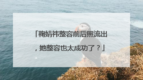 鞠婧祎整容前后照流出,她整容也太成功了?