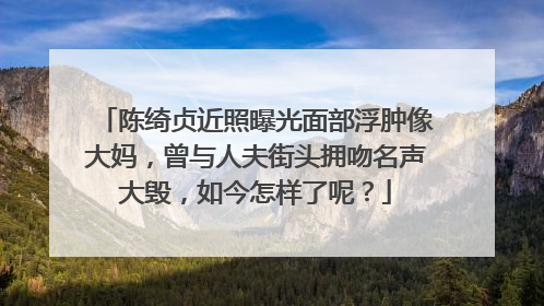 陈绮贞近照曝光面部浮肿像大妈，曾与人夫街头拥吻名声大毁，如今怎样了呢？