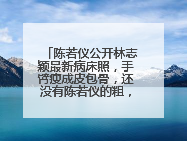 陈若仪公开林志颖最新病床照,手臂瘦成皮包骨,还没有陈若仪的粗,咋回事?