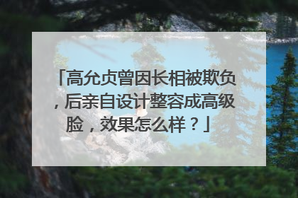 高允贞曾因长相被欺负，后亲自设计整容成高级脸，效果怎么样？