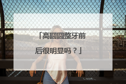 高圆圆整牙前后很明显吗？