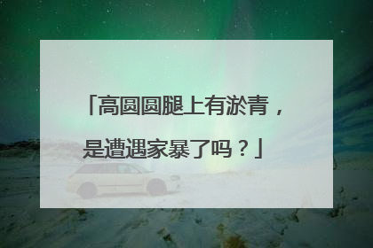 高圆圆腿上有淤青，是遭遇家暴了吗？