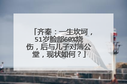 齐秦：一生坎坷，51岁脸部60%烧伤，后与儿子对簿公堂，现状如何？