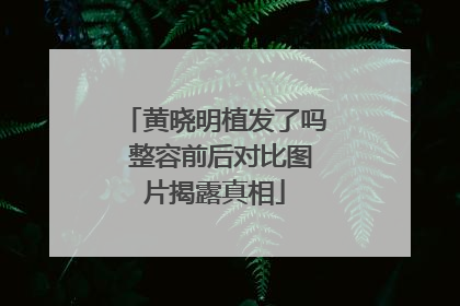 黄晓明植发了吗 整容前后对比图片揭露真相