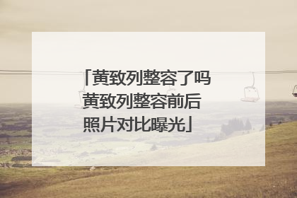黄致列整容了吗 黄致列整容前后照片对比曝光