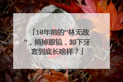 10年前的“林无敌”,摘掉眼镜,卸下牙套到底长啥样?
