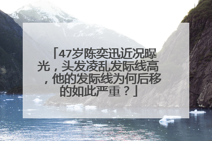 47岁陈奕迅近况曝光,头发凌乱发际线高,他的发际线为何后移的如此严重?