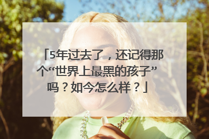 5年过去了，还记得那个“世界上最黑的孩子”吗？如今怎么样？