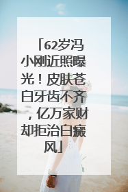 62岁冯小刚近照曝光!皮肤苍白牙齿不齐,亿万家财却拒治白癜风