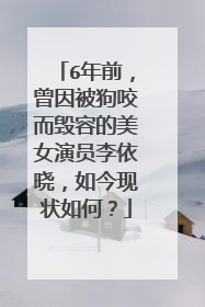 6年前,曾因被狗咬而毁容的美女演员李依晓,如今现状如何?