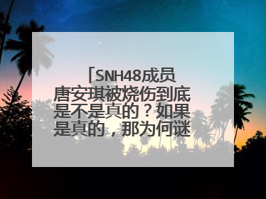 SNH48成员唐安琪被烧伤到底是不是真的?如果是真的,那为何谜底那么多?