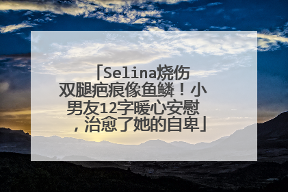 Selina烧伤双腿疤痕像鱼鳞！小男友12字暖心安慰，治愈了她的自卑
