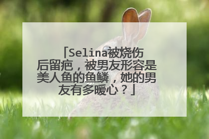 Selina被烧伤后留疤,被男友形容是美人鱼的鱼鳞,她的男友有多暖心?