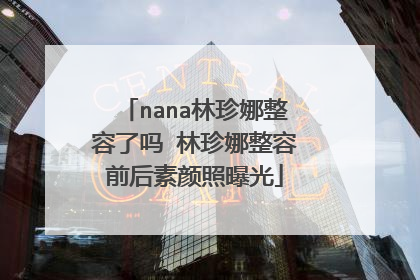 nana林珍娜整容了吗 林珍娜整容前后素颜照曝光