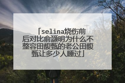 selina烧伤前后对比俞灏明为什么不整容田馥甄的老公田馥甄让多少人睡过