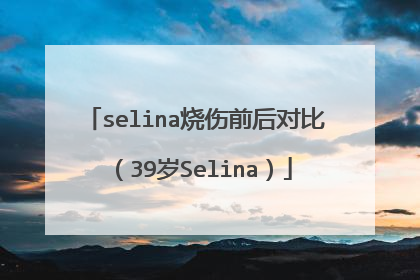 selina烧伤前后对比（39岁Selina）